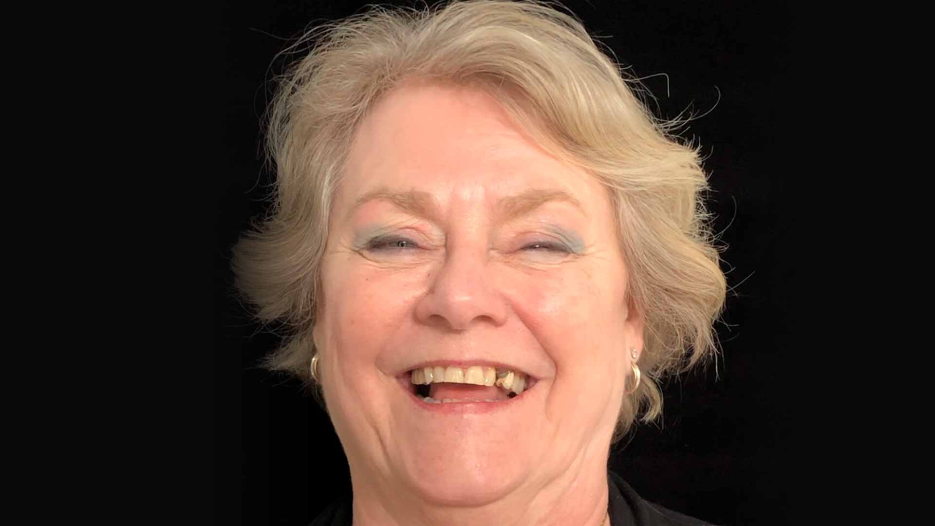 A close-up of an older woman smiling to show her teeth before having dental implants.