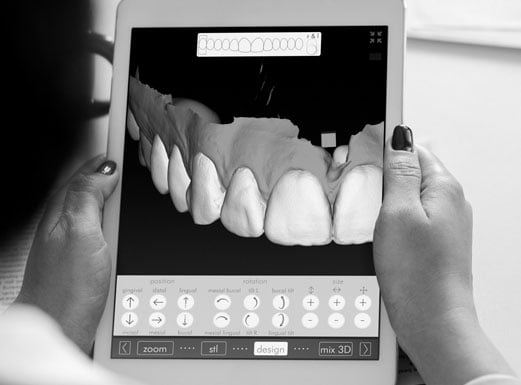 IDC_Invisalign_Slider_02