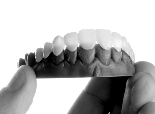 IDC_Invisalign_Slider_03