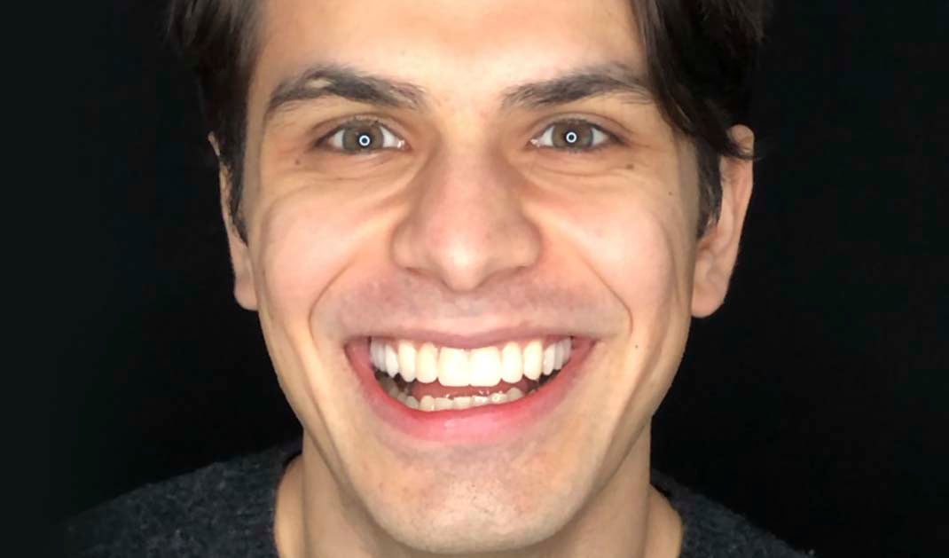 A patient smiling after his dental treatment at Ironwood Dental Care.