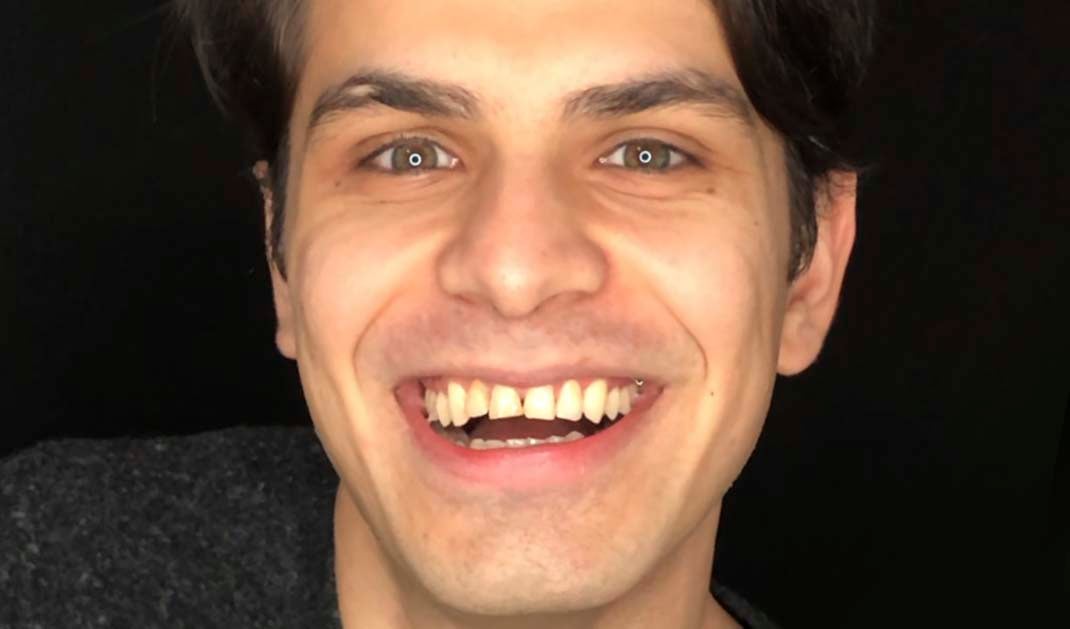 A patient smiling before his dental treatment at Ironwood Dental Care.