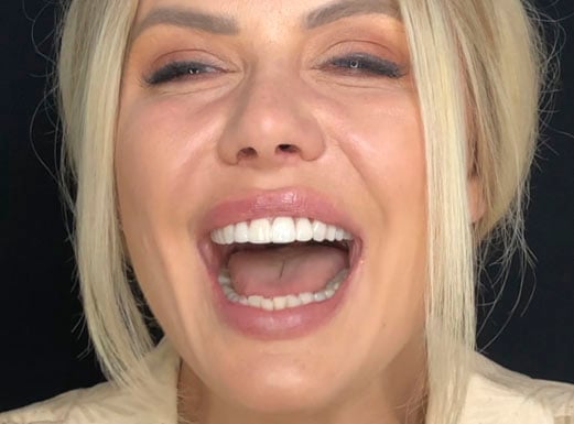 A close-up of a young woman smiling to show her new teeth after dental treatment at Ironwood Dental Care.