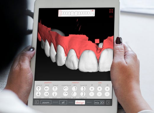 Dentist Dr Sheena Sood looking at the design of a patient's smile on the Digital Smile Design app.