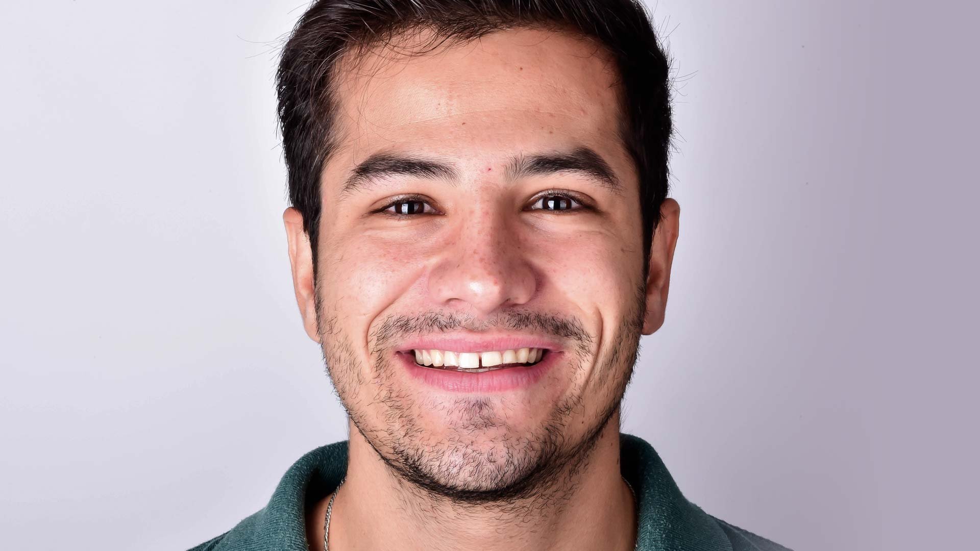 A young man smiling to show his teeth before his dental treatment with Digital Smile Design.
