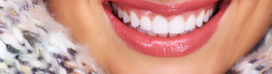 Porcelain vs. Composite Veneers