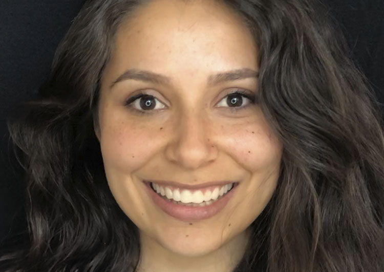 A young woman smiling to show how a smile could look after Lite Dentistry.