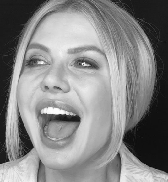 A close-up of a young woman smiling to show her new straight, white teeth after dental treatment at Ironwood Dental Care.