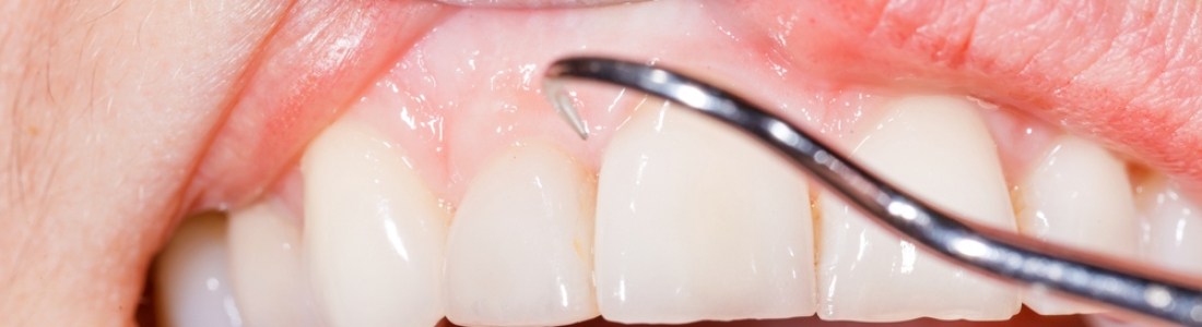 PERIODONTAL DISEASE AND SYSTEMIC HEALTH